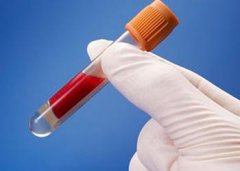 開冉制冷醫(yī)藥血漿冷庫設(shè)計(jì)優(yōu)勢